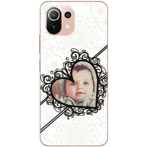 Love Frame Custom Photo Case for Mi 11 Lite