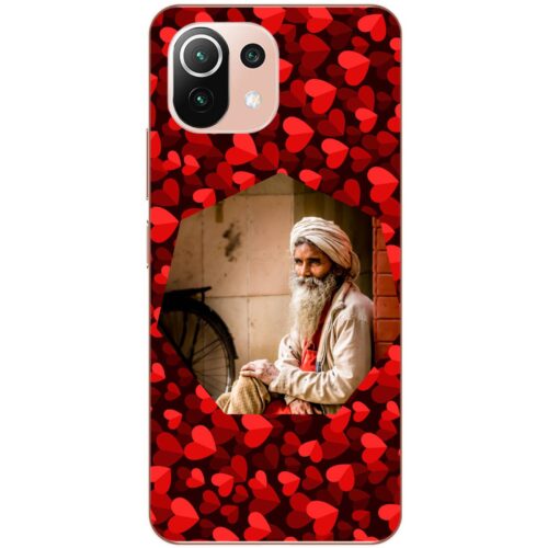 #8 Hexagon Custom Photo Case for Mi 11 Lite