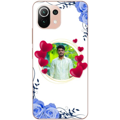 Loved ones face photo case for Mi 11 Lite